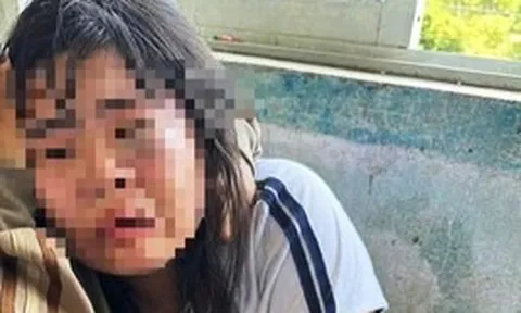 Nữ sinh lớp 7 bị 2 nam sinh lớp 9 đánh nhập viện