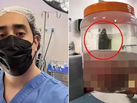 Bác sĩ chụp ảnh sau ca phẫu thuật, xem lại mới thấy một chi tiết gây “rùng mình”