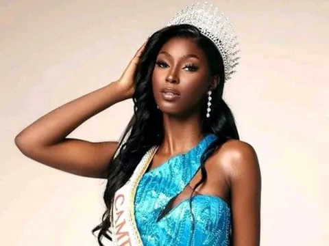 Đương kim Miss Cameroon 2025 bị tạm giam