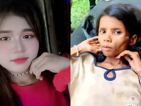 Bé gái mất tích 47 ngày trong rừng, gầy trơ xương khi được tìm thấy, giờ ra sao?